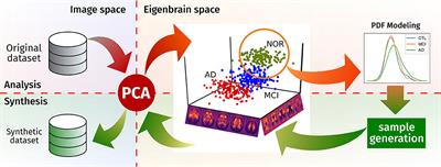 Functional Brain Imaging Synthesis Based on Image Decomposition and Kernel Modeling: Application to Neurodegenerative Diseases